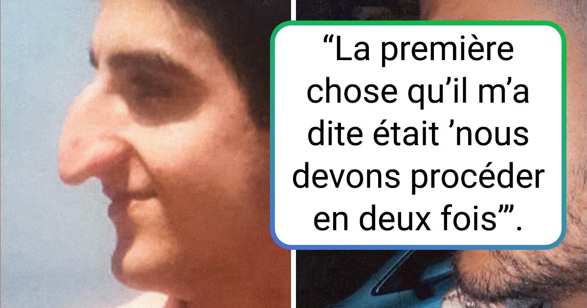 18 Personnes qui ont décidé de se soumettre à un procédé esthétique et ont changé radicalement leur physique et leur estime de soi