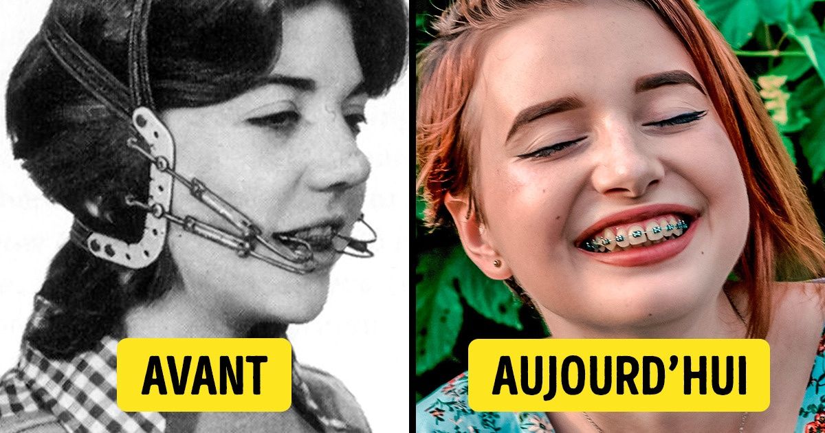 Voilà à quoi ressemblaient ces 15 articles de beauté il y a 100 ans Voilà à quoi ressemblaient ces 15 articles de beauté il y a 100 ans