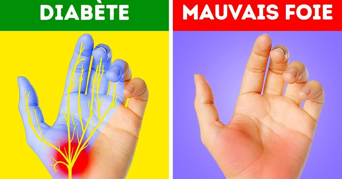 12 Problèmes de Santé Que Tes Mains T’indiquent