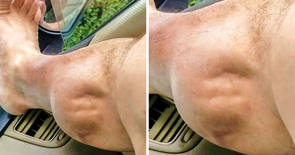 Découvre ces 12 manières pour te débarrasser des crampes dans les jambes et éviter qu’elles reviennent
