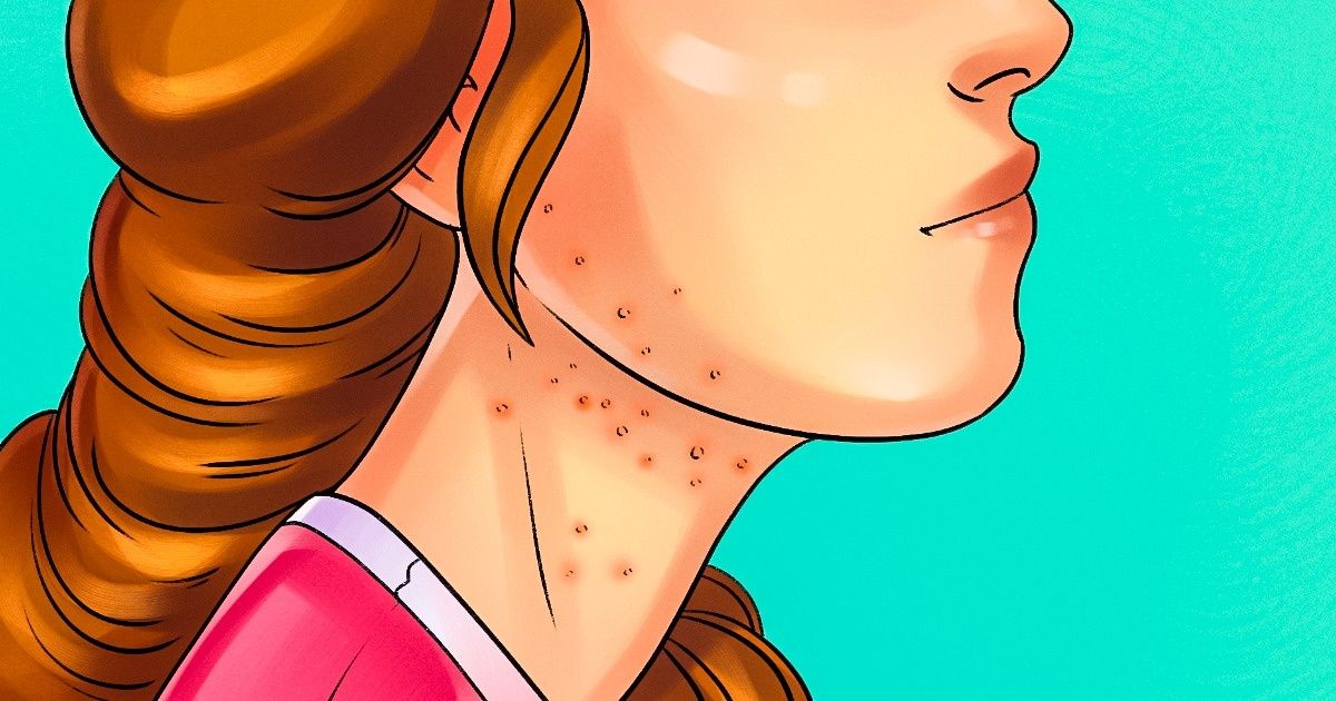 9 signes qui indiquent que tu manges trop de sucre