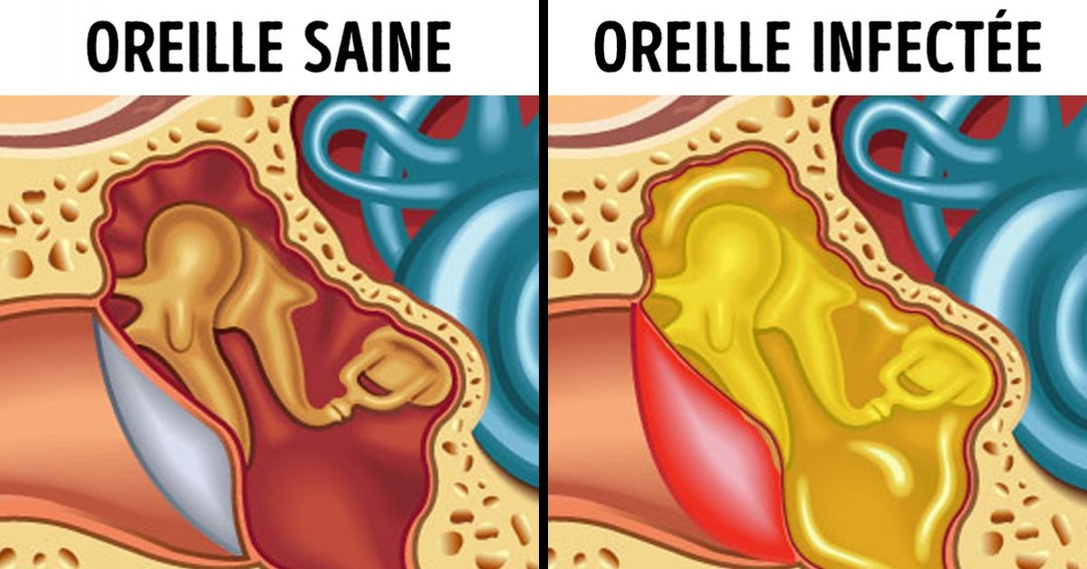 Quels symptômes peuvent indiquer que ton enfant n’entend pas bien et quelles sont les solutions pour y remédier ?
