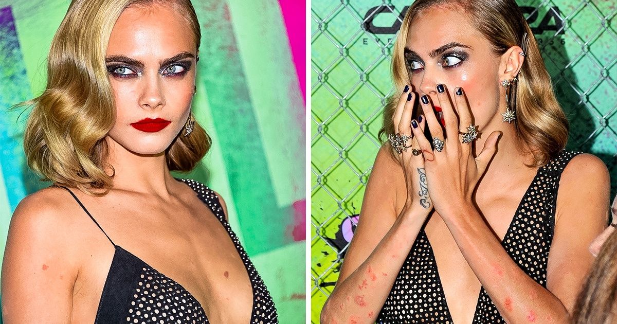 11 femmes qui ont un succès fou dans le monde de la mode malgré leurs imperfections physiques