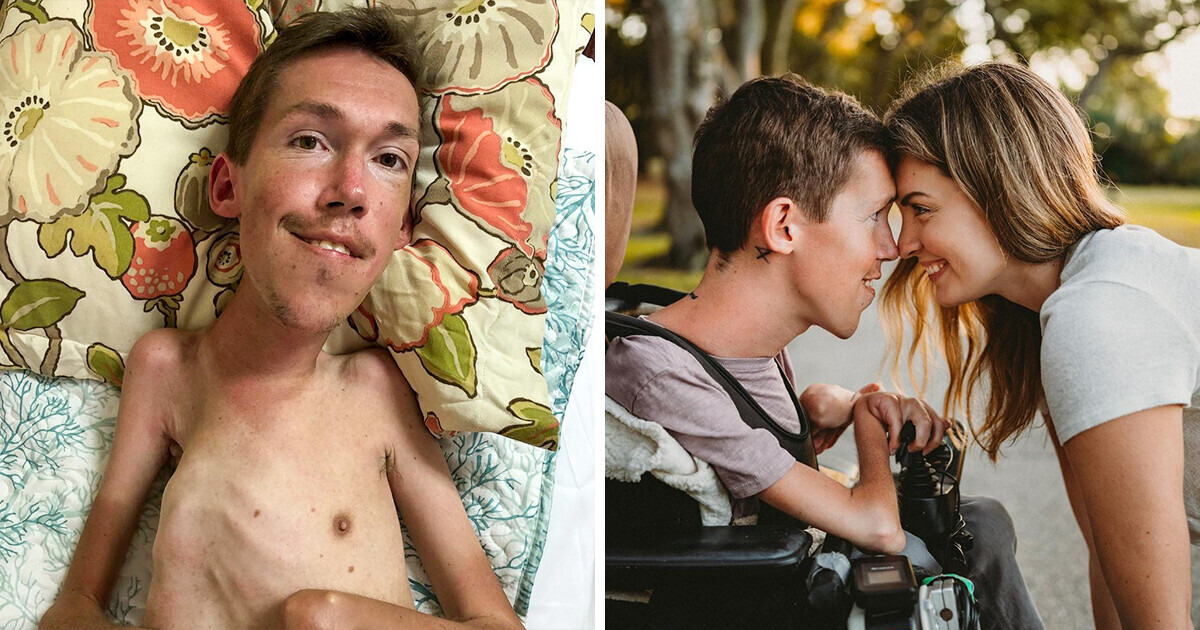 Ce jeune homme handicapé a une vie amoureuse exceptionnelle et prévoit d’avoir un bébé bientôt Ce jeune homme handicapé a une vie amoureuse exceptionnelle et prévoit d’avoir un bébé bientôt