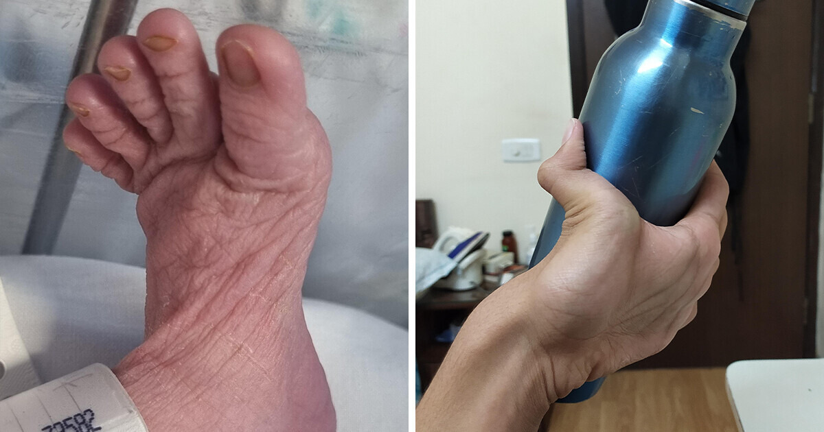 19 Personnes dont les caractéristiques corporelles les distinguent du reste du monde