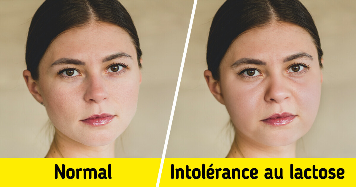 12 Signes que ton corps t’envoie pour t’indiquer une intolérance au lactose 12 Signes que ton corps t’envoie pour t’indiquer une intolérance au lactose
