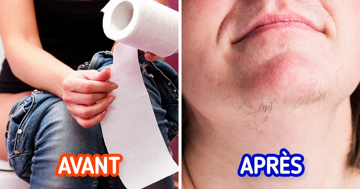 6 Raisons pour lesquelles tes poils sur le visage pourraient pousser plus vite