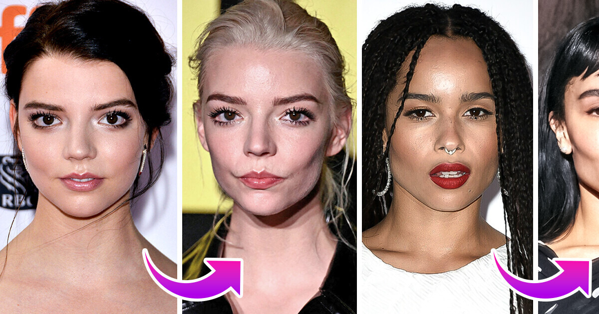 14 Célébrités qui ont sculpté leurs pommettes et métamorphosé leur apparence 14 Célébrités qui ont sculpté leurs pommettes et métamorphosé leur apparence