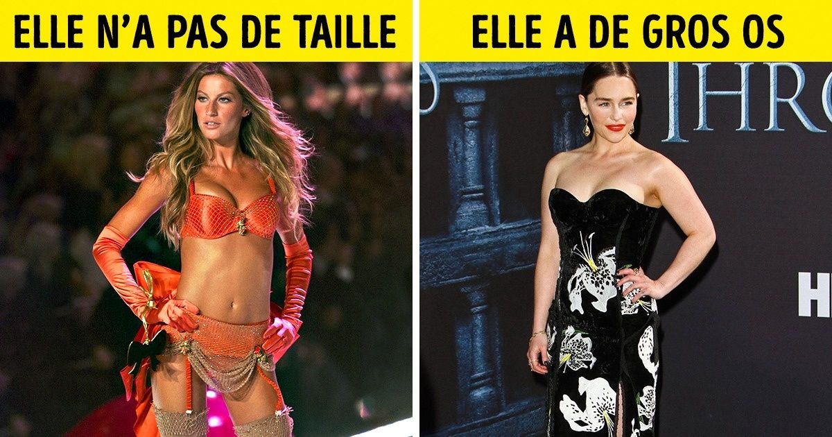 Ces 7 célébrités ont transformé leurs plus gros complexes en atouts !