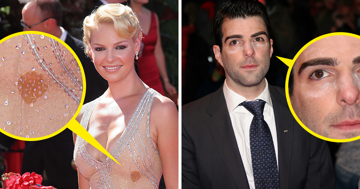 15 + Petits malheurs qui prouvent que les célébrités sont des humains comme les autres