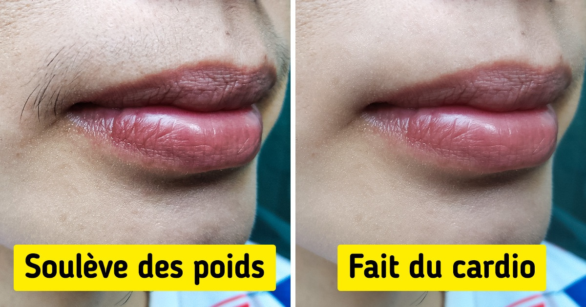 6 Façons d’empêcher naturellement la pousse de poils sur le visage 6 Façons d’empêcher naturellement la pousse de poils sur le visage