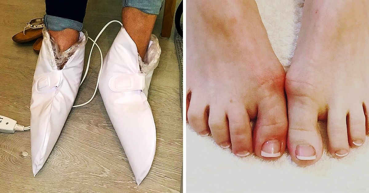 25 Dispositifs cosmétiques qui semblent irréels mais qui pourtant existent 25 Dispositifs cosmétiques qui semblent irréels mais qui pourtant existent