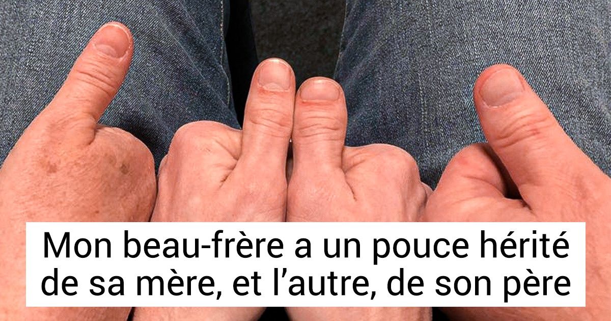 20 Personnes qui nous montrent les merveilles de la génétique 20 Personnes qui nous montrent les merveilles de la génétique