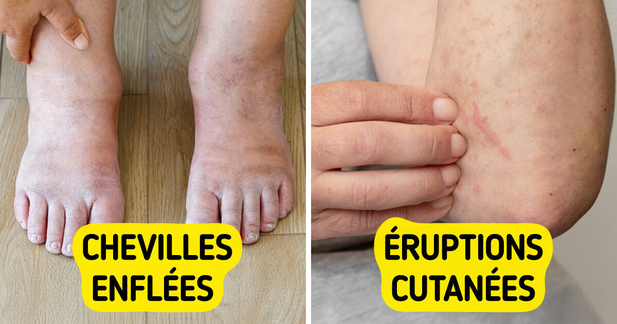 7 Signes cruciaux que ton corps essaie de t'avertir de ton état de santé 7 Signes cruciaux que ton corps essaie de t'avertir de ton état de santé