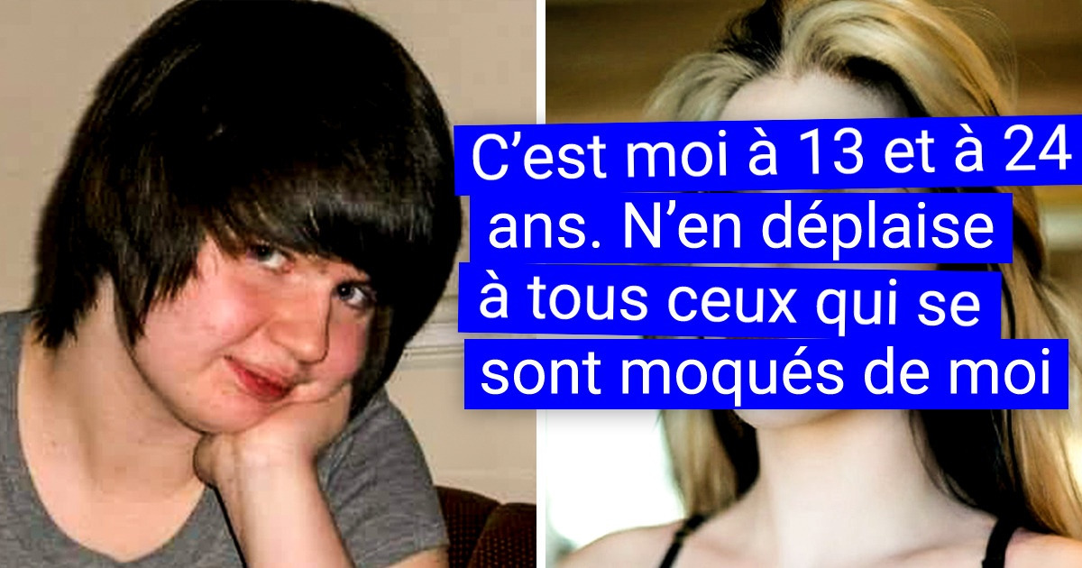 20+ Veinards qui ont fait un glow-up si spectaculaire que l’entourage n’en revient pas