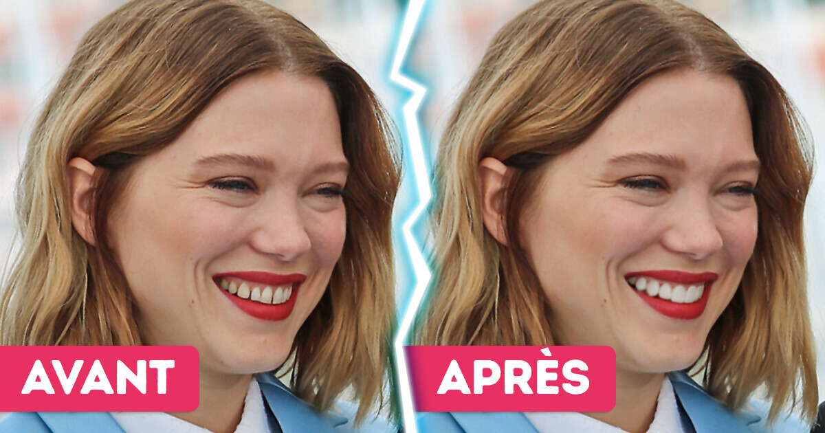 Nous avons altéré le signe le plus distinctif de 12 stars pour démontrer que rien n’égale leur charisme naturel