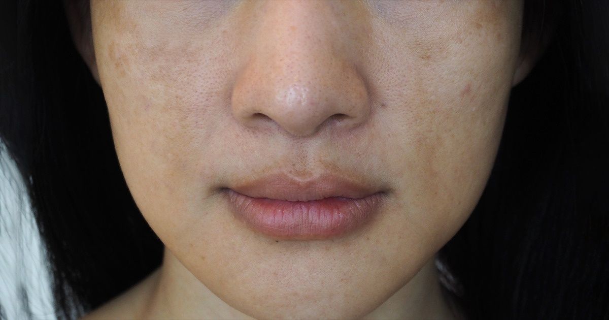 10 Signes qui montrent que ton corps manque de vitamine C 10 Signes qui montrent que ton corps manque de vitamine C