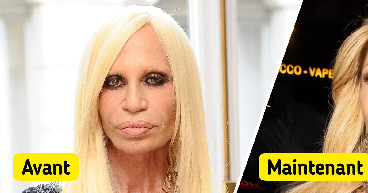 Donatella Versace se présente avec un "nouveau visage", elle est méconnaissable