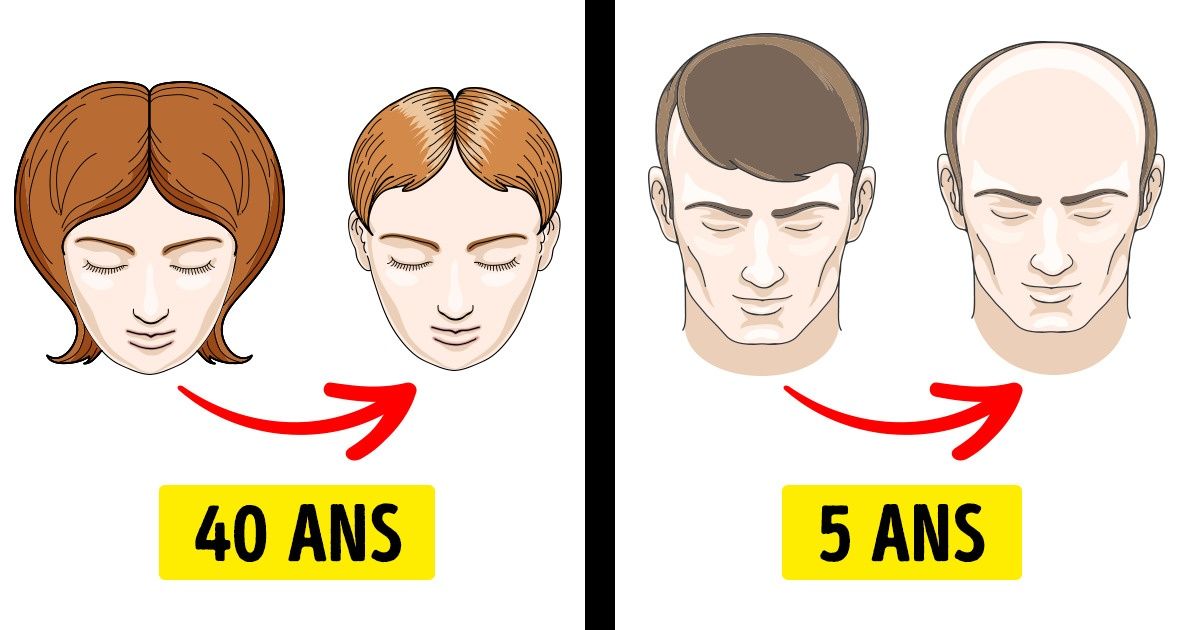 8 Maladies qui affectent différemment les hommes et les femmes