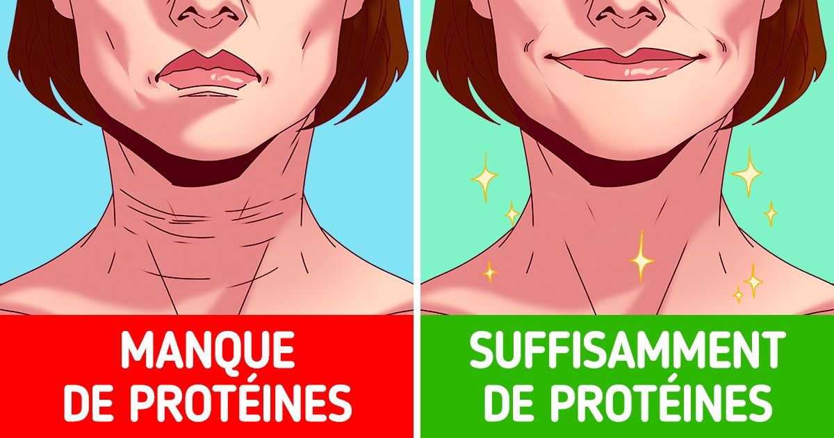 5 Facteurs qui favorisent l’apparition de rides sur la peau