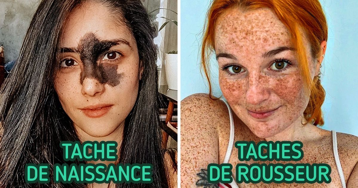 15+ Individus qui ont stupéfait le monde par leur beauté atypique mais authentique