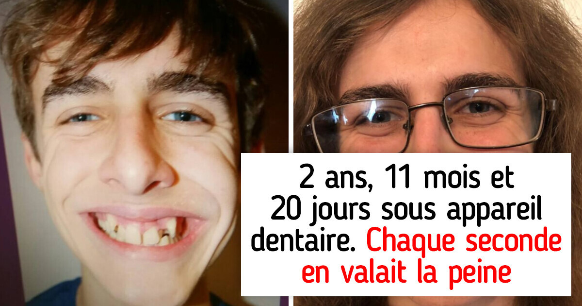 15+ Photos avant et après qui montrent ce que le temps peut faire