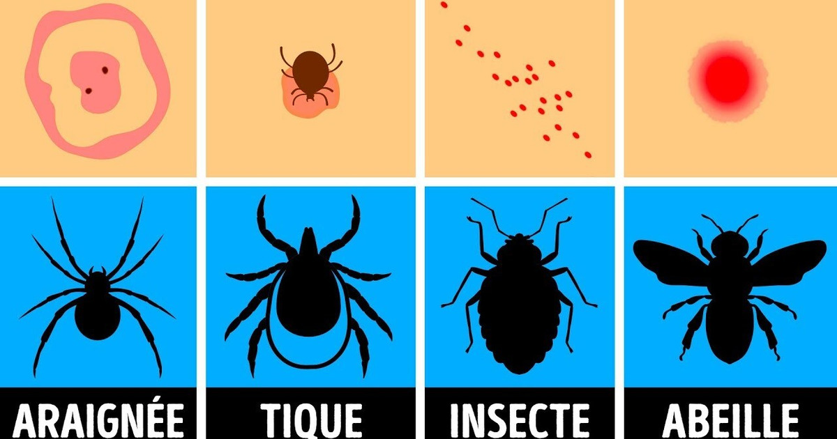 Comment Identifier une Piqûre d’Insecte et que Faire Quand ça Arrive