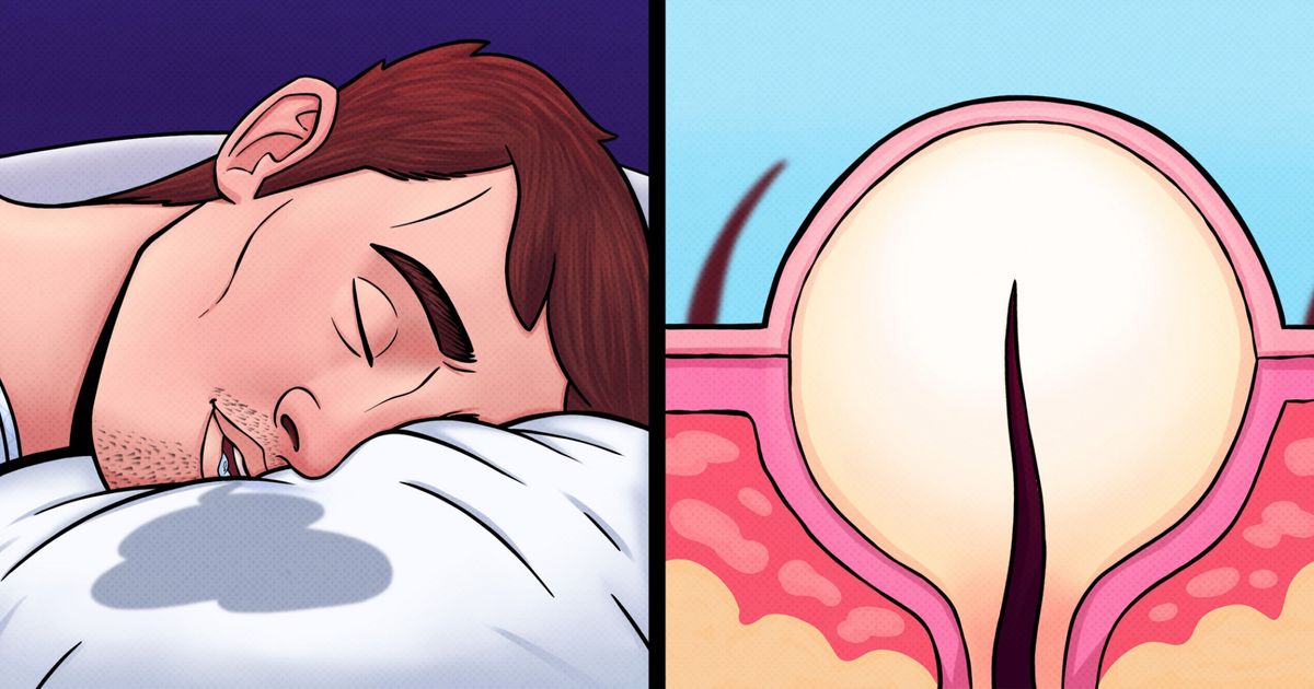 10 Choses quotidiennes qui ruinent secrètement ta peau 10 Choses quotidiennes qui ruinent secrètement ta peau