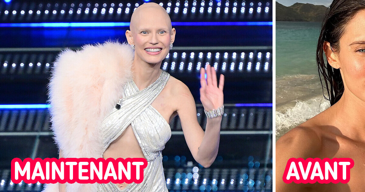 Un mannequin de Victoria's Secret fait sensation en affichant sa cicatrice et son crâne rasé lors d'un festival