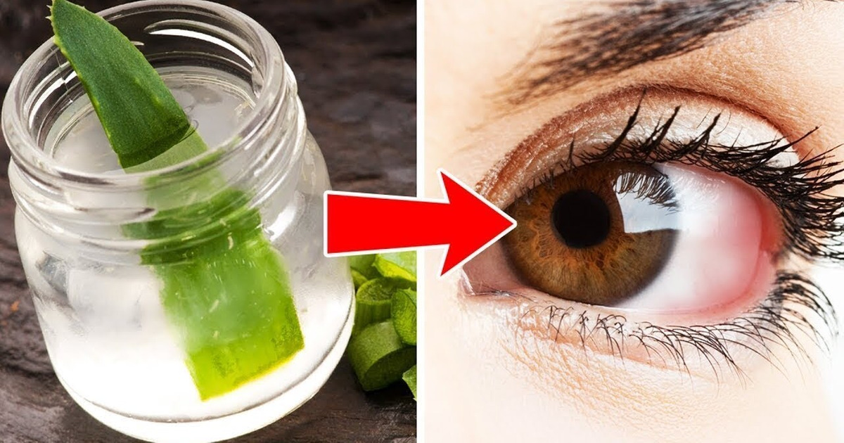 5 Manières D’améliorer ta Vue Sans Porter de Lunettes 5 Manières D’améliorer ta Vue Sans Porter de Lunettes