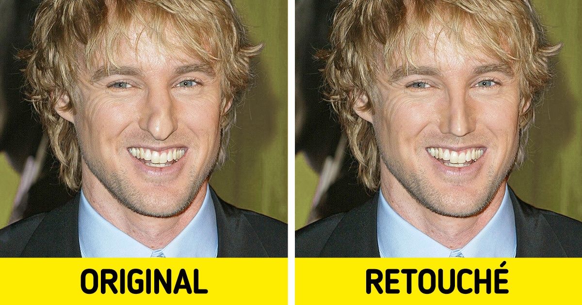 18 Célébrités avec un nez particulier qui nous prouvent que les complexes ne mènent nulle part