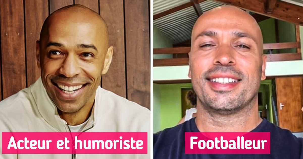 10 Célébrités francophones dont le charme réside dans leur crâne rasé et lisse