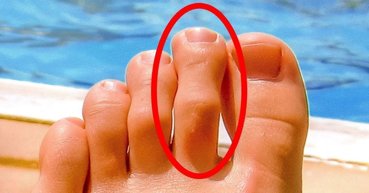 8 SIGNES QUI MONTRENT QUE TON CORPS CRIE AU SECOURS