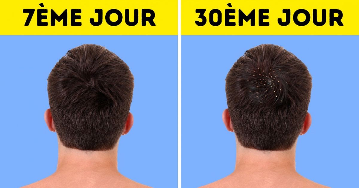 Voici 10 choses relativement graves qui t’arriveront si tu arrêtes de te doucher