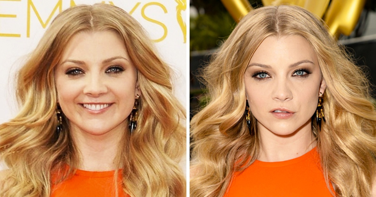 13 Célébrités qui n’ont pas honte de leurs particularités physiques