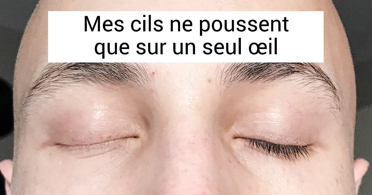 20+ Personnes qui n’ont pas eu peur de montrer les particularités que leur a offert dame nature
