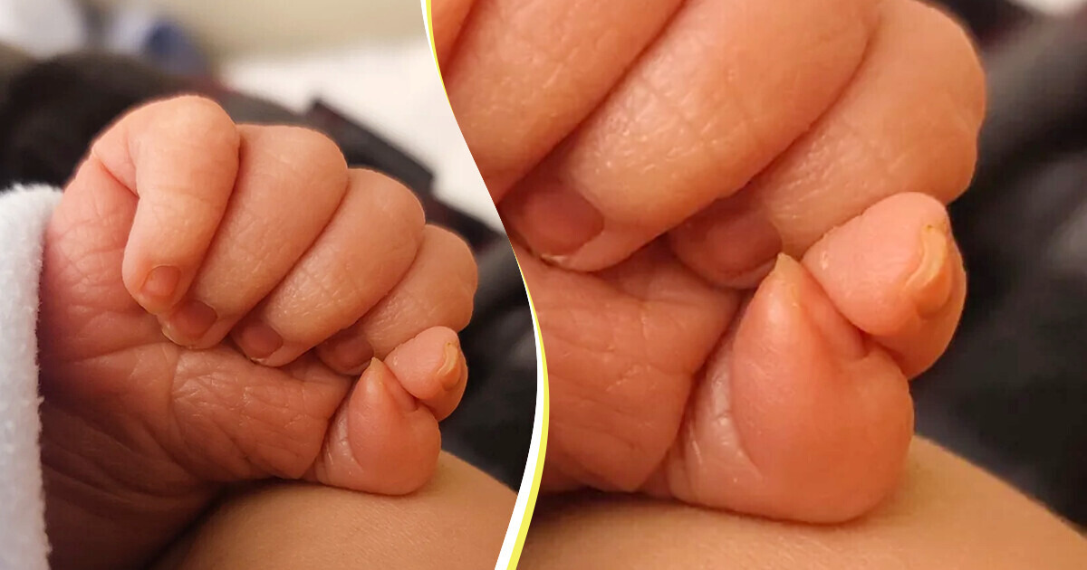 12 Fois où le corps humain a fait preuve d'une créativité remarquable