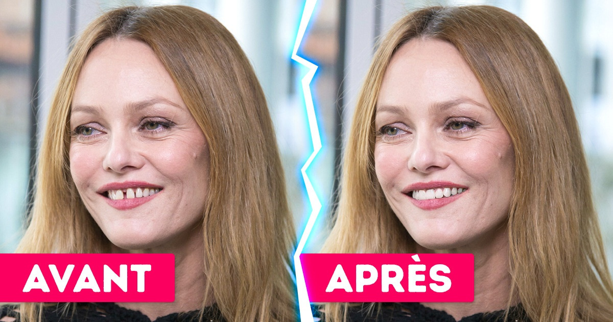 Nous avons changé le trait le plus distinctif de 15 célébrités pour montrer que rien ne vaut le charisme naturel Nous avons changé le trait le plus distinctif de 15 célébrités pour montrer que rien ne vaut le charisme naturel