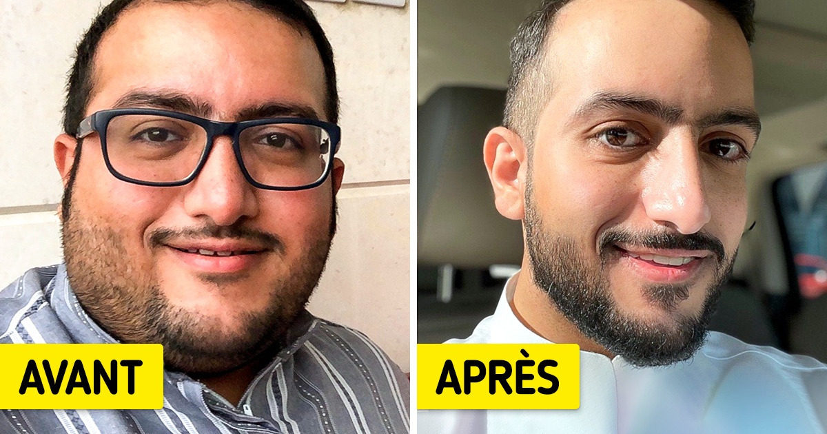 17 Personnes qui ont fait preuve d’une immense volonté afin de subir une incroyable transformation