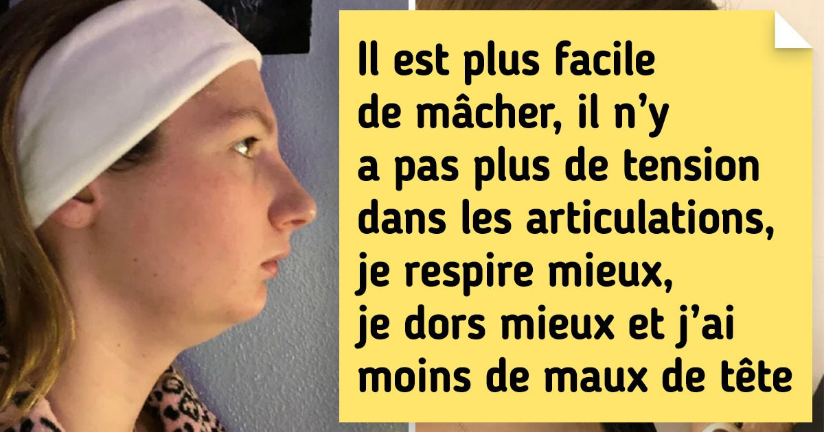 20+ Personnes qui se sont fait modifier un petit détail ont partagé le résultat avec les autres