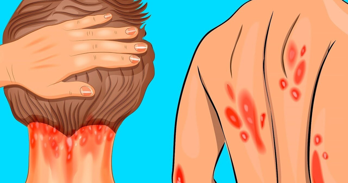 10 Signes qui indiquent une déficience en vitamine D