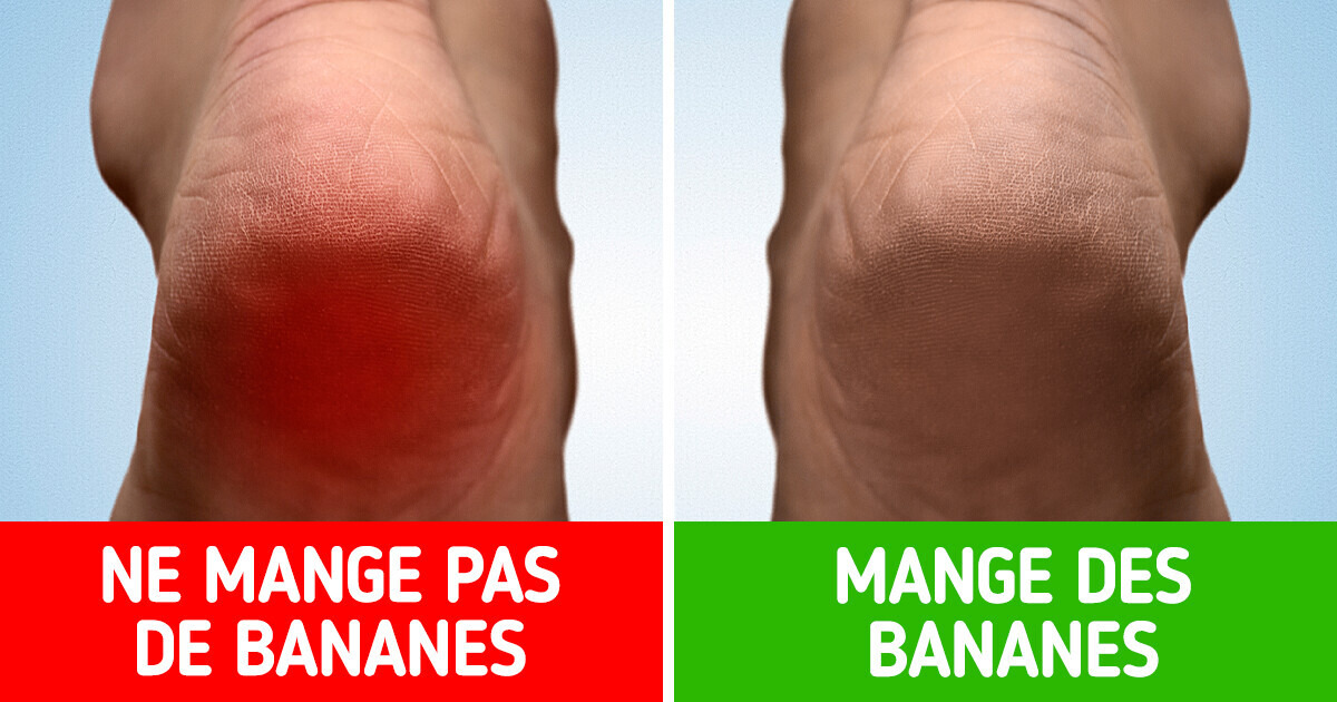 10 Choses qui pourraient arriver à notre corps si nous mangions des bananes tous les jours