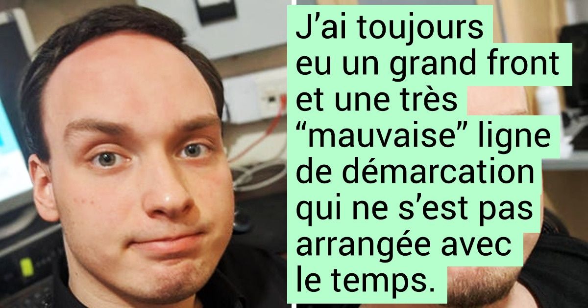 24 Exemples d’hommes courageux qui ont décidé d’assumer pleinement leur calvitie, et qui ont bien fait