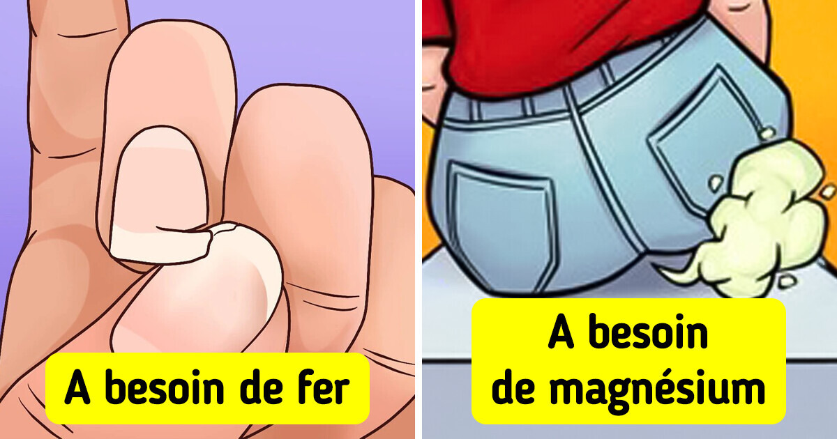 7 Signes que ton corps manque de nutriments essentiels 7 Signes que ton corps manque de nutriments essentiels