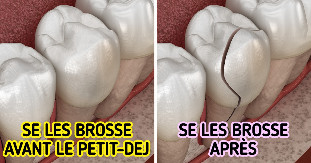 Découvre pourquoi il vaut mieux éviter de se brosser les dents après le petit-déjeuner