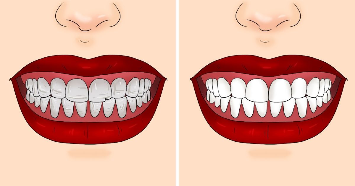 Qu’arriverait-il dans ton corps si tu mangeais du céleri pendant une semaine ? Qu’arriverait-il dans ton corps si tu mangeais du céleri pendant une semaine ?