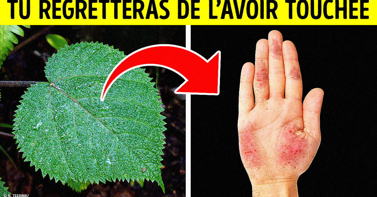 Une Plante Hostile Dont la Piqûre Dure des Années