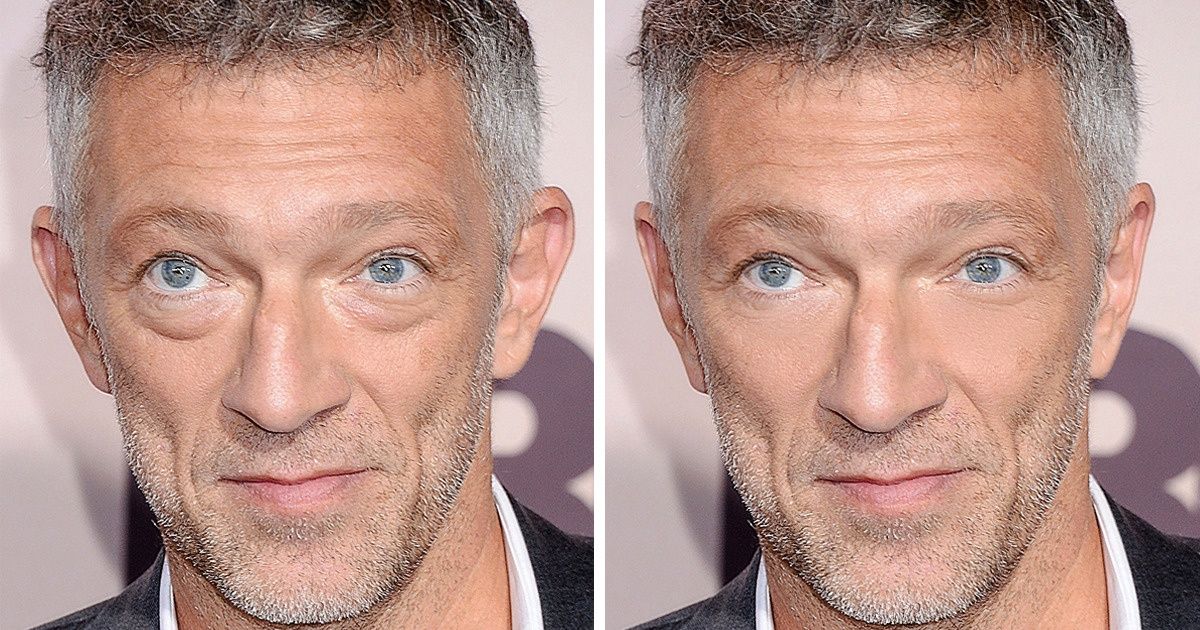 Nous avons imaginé à quoi ressembleraient 11 célébrités françaises sans leur particularité physique unique