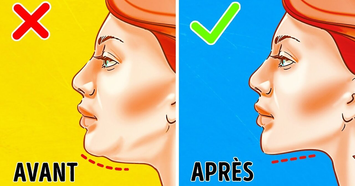 LES 7 EXERCICES LES PLUS EFFICACES POUR SE DÉBARRASSER D’UN DOUBLE MENTON LES 7 EXERCICES LES PLUS EFFICACES POUR SE DÉBARRASSER D’UN DOUBLE MENTON