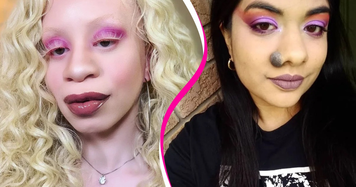 18 Personnes qui sont ravies de leurs caractéristiques uniques et qui le crient aux quatre vents